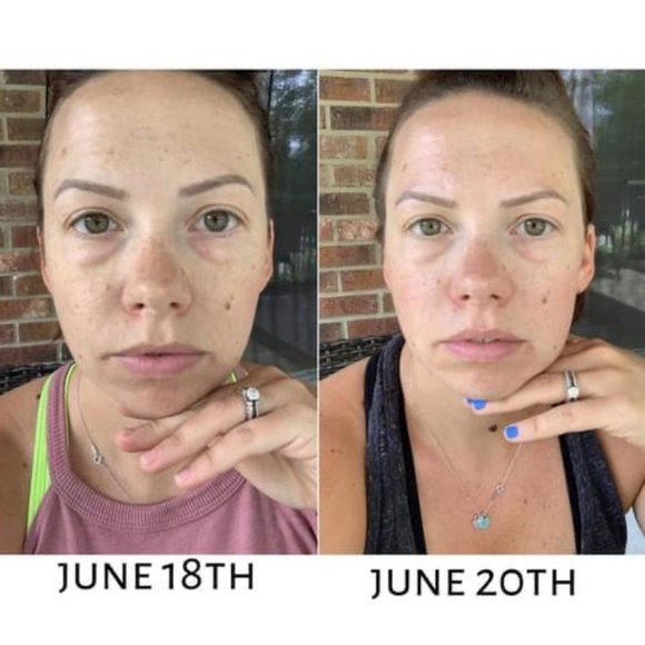 you ology eye cream